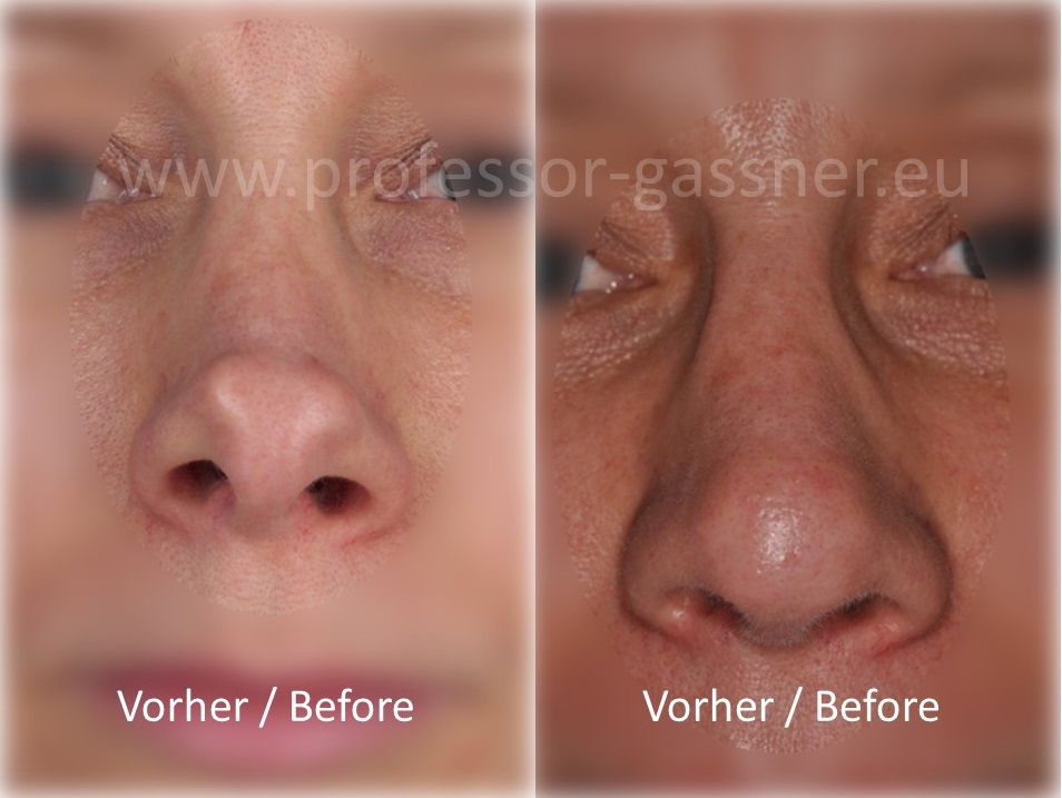 Bild 1 und Bild 2 ohne Rand